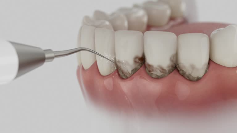 Reliable Dental Implants contractor in Saranap, CA by Smile Center Dentistry